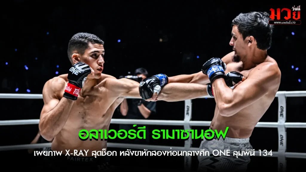 รามาซานอฟเผยภาพ X-ray สุดช็อก